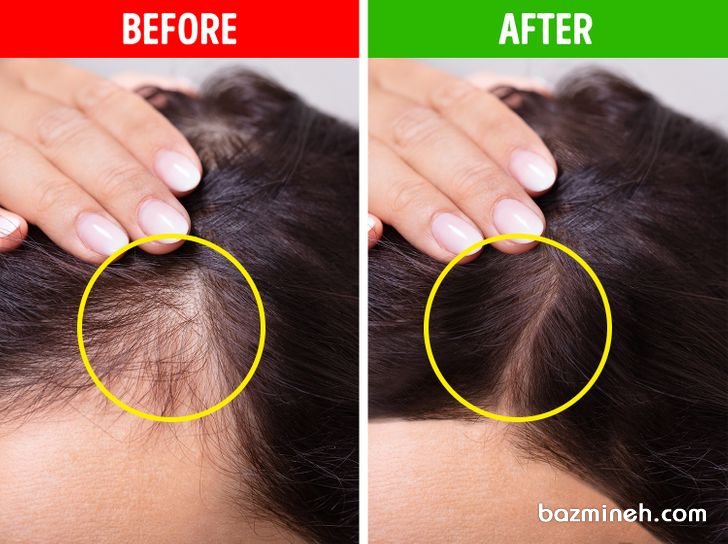 9 روش شگفت انگیز که موهای نازک را ضخیم تر می کند